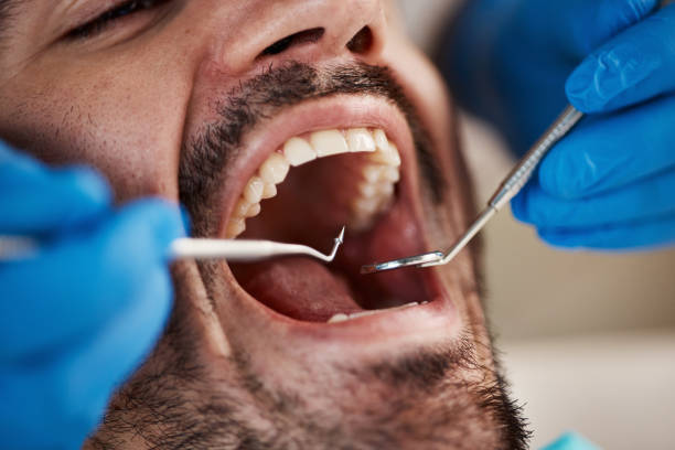 Best Emergency Dental Services for Seniors in Fillmore, UT